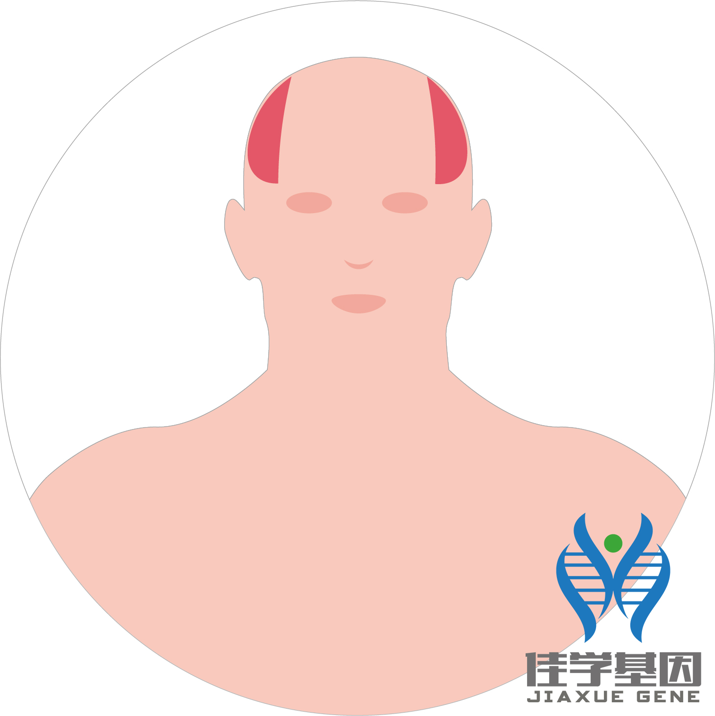 【佳學(xué)基因檢測】男性<font color='red'>脫發(fā)</font>（Androgenetic alopecia）基因解碼、<a href=http://vigrxplusreviewsreal.com/tk/jiema/cexujishu/2021/31933.html>基因檢測</a>