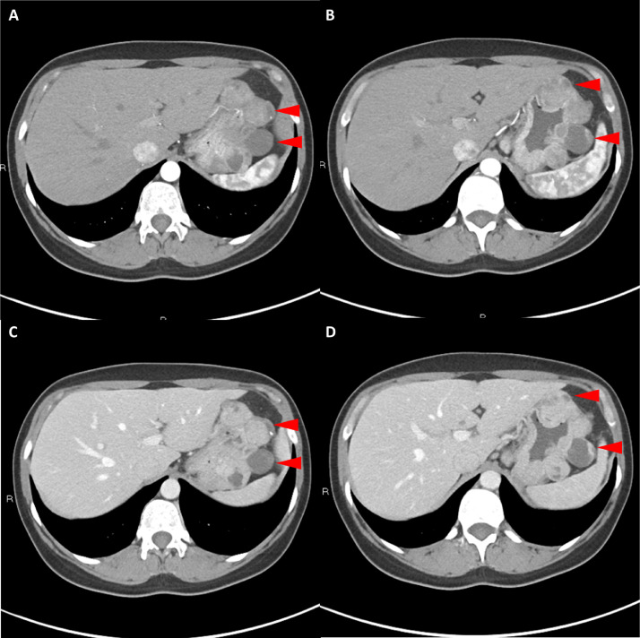 Fig. 2  