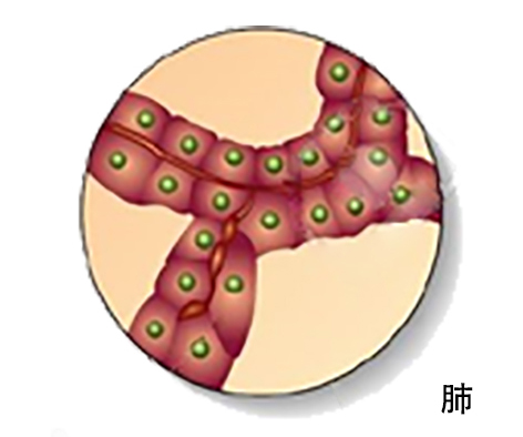 【佳學(xué)基因解碼-基因檢測】特發(fā)性肺動脈高壓病基因解碼基因檢測